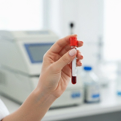 Close-up shot of a woman's hand holding a blood test sample tube with a blurred laboratory background. The focus is on the sample tube and the woman's hand, conveying the idea of hormone measurement. No text, no words, no typography, no labels, clean image.